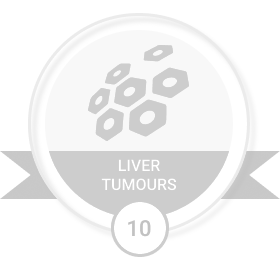 Liver Tumours level 10