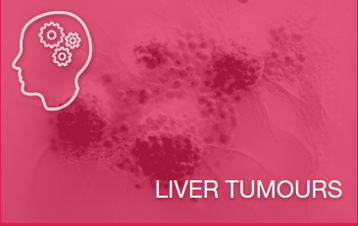 EASL Quiz