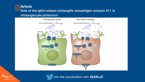 EASL Journal Club: Role of the IgG4-related cholangitis autoantigen annexin A11 in cholangiocyte protection